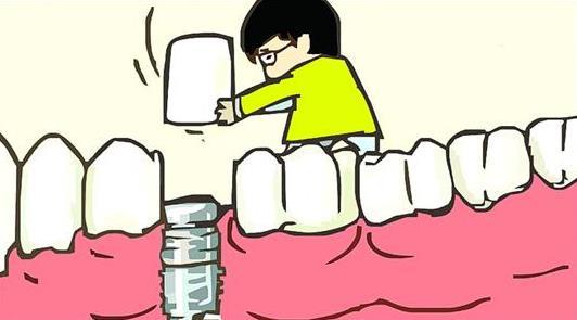 深圳羅湖種植牙價(jia) 格