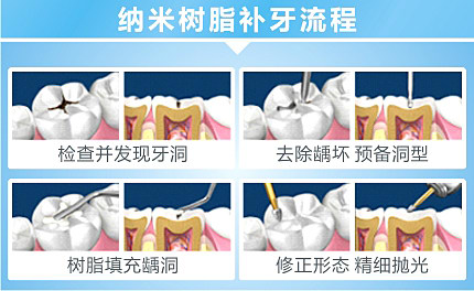 孕婦補牙有沒有危害