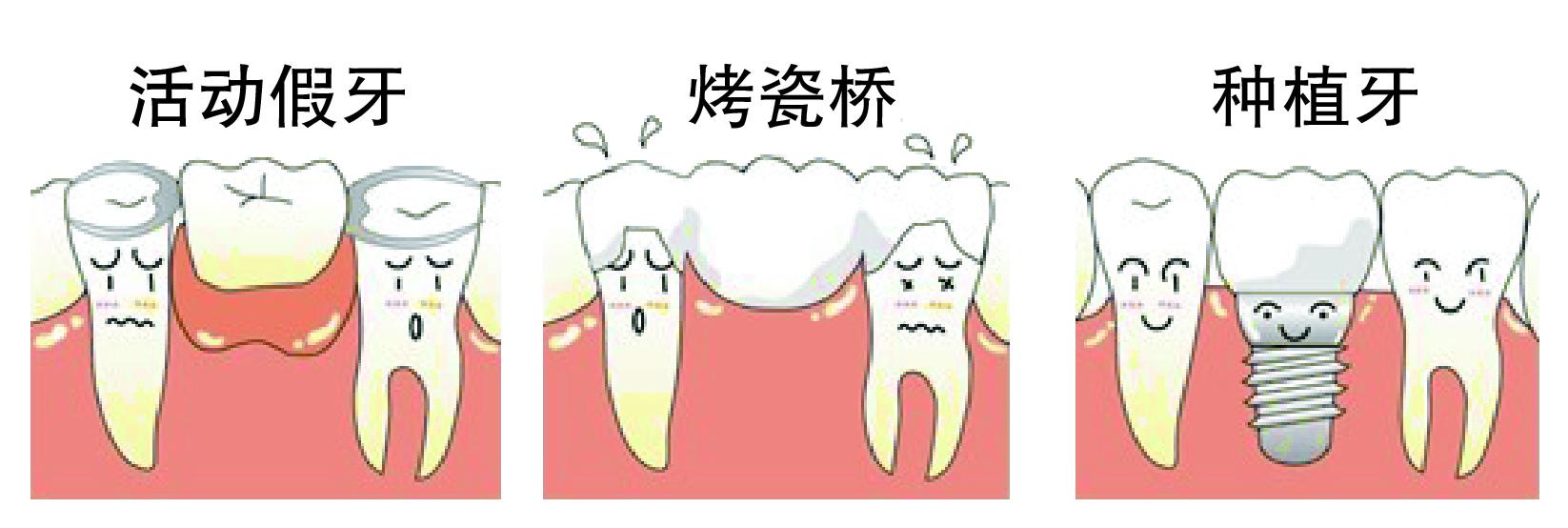 深圳裝假牙的價(jia) 格