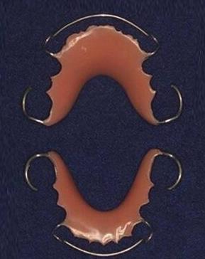 Hawley（哈雷）保持器多少錢