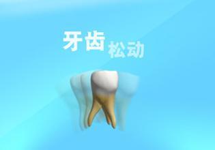 大牙鬆動的圖片