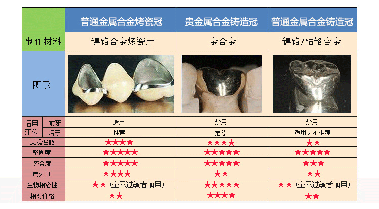 後牙做什麽(me) 牙冠好