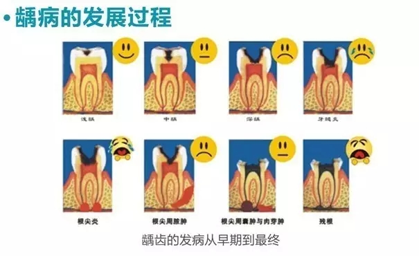 乳牙蛀壞的危害