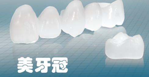 美牙冠多少錢一顆