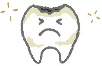 牙齒沒有壞也需要修補嗎