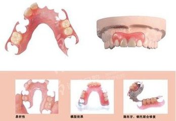 安活動假牙的後遺症