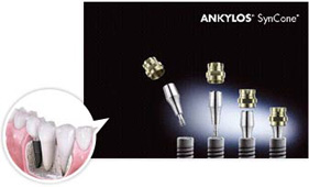 ankylos種植牙價(jia) 格