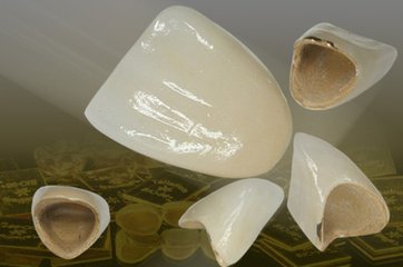 做完烤瓷牙之後牙疼的原因