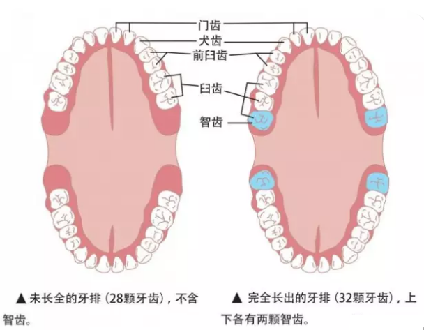 智齒需要拔除嗎