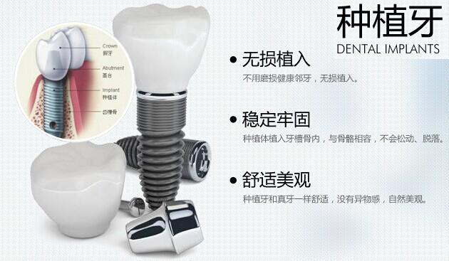 牙齒掉了20多年還能種植牙嗎