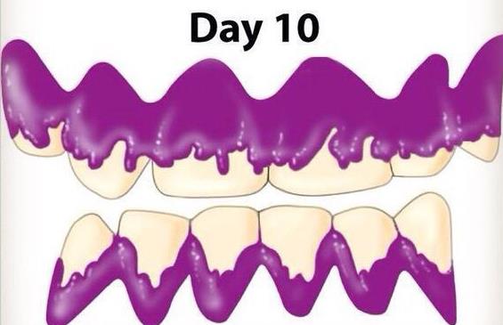 清除牙菌斑的方法
