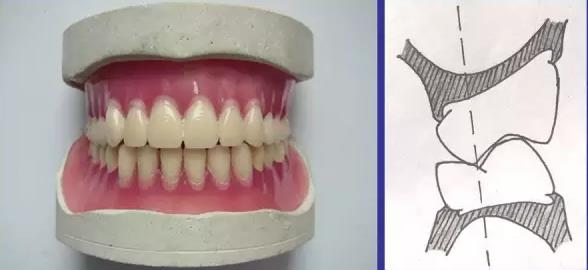 口腔全口義(yi) 齒