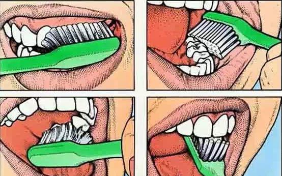 預防牙齦炎好好刷牙