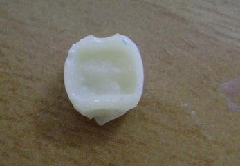 臨(lin) 時牙是用什麽(me) 材料做的