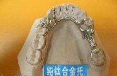 活動義(yi) 齒金屬托多少錢