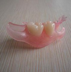  活動隱形義(yi) 齒價(jia) 格