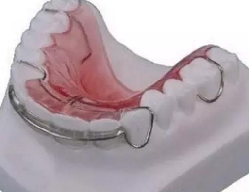 牙齒矯正後終身戴保持器的情況