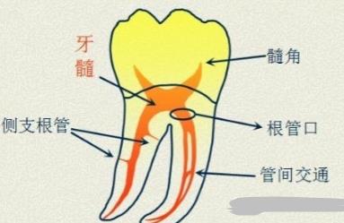 根管治療需要上幾次藥