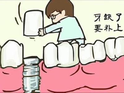 種牙大概價(jia) 格