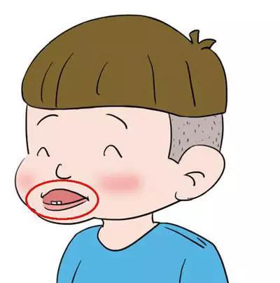 乳牙地包天不矯正可以嗎