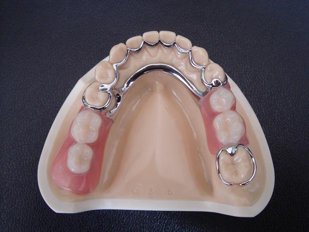 活動假牙價(jia) 格