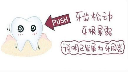 牙齒鬆動怎麽(me) 辦