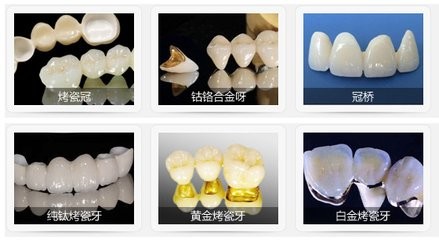 烤瓷牙後牙齦發炎