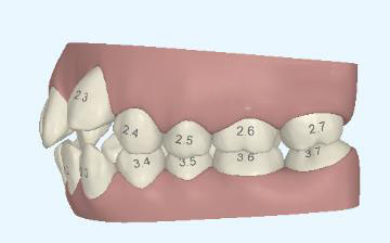 牙齒整齊有什麽(me) 好處