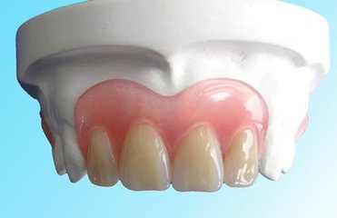 隱形義(yi) 齒和活動義(yi) 齒哪種好