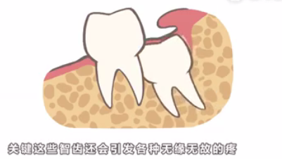 智齒是什麽(me) 樣子的