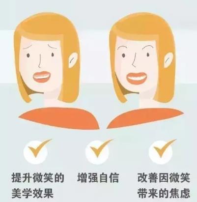 露齦笑要不要改善