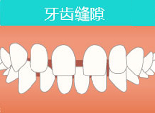 牙齒稀疏是腎不好嗎