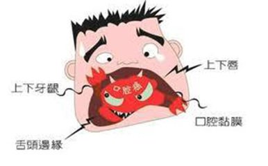 怎樣預防口腔癌
