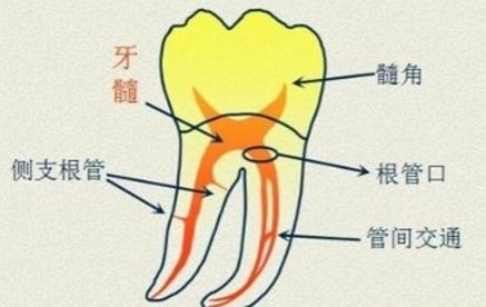 兒(er) 童根管治療
