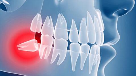 智齒長歪了拔不拔