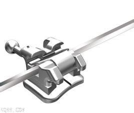 自鎖托槽矯正結果