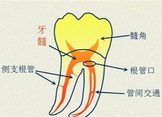 根管治療的目的