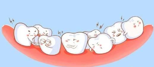 正畸拔牙