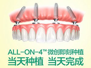 全口種植牙的價(jia) 格和哪些因素有關(guan) 