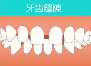 牙齒稀疏多少錢