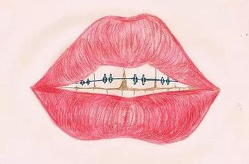 箍牙會(hui) 遇到什麽(me) 問題