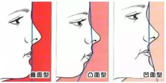 正畸需要拔牙的情況