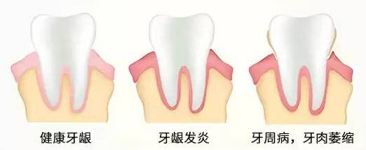 深圳醫院洗牙