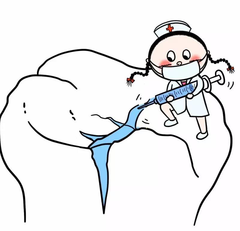 窩溝封閉多少錢