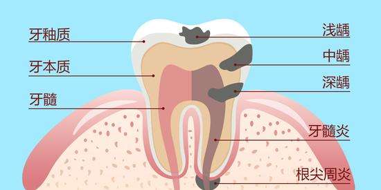 補一顆牙的價(jia) 格