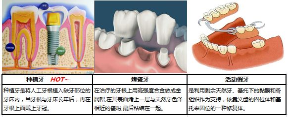 假牙多少錢