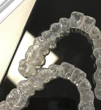 時代天使隱形矯正暴牙的價(jia) 格