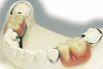 活動牙能從(cong) 鋼托換塑料托嗎