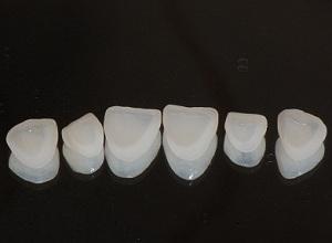 瓷貼麵能保持多久