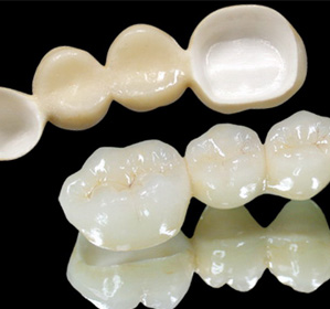 全瓷牙的價(jia) 格